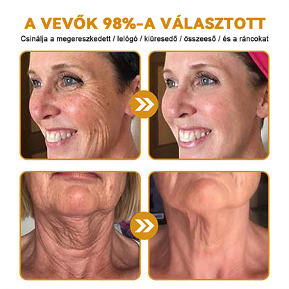 💥【Hivatalos Márkabolt】FRISSARC™ Botox Méhméreg Ránctalanító Krém