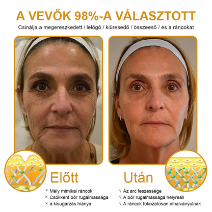 💥【Hivatalos Márkabolt】FRISSARC™ Botox Méhméreg Ránctalanító Krém