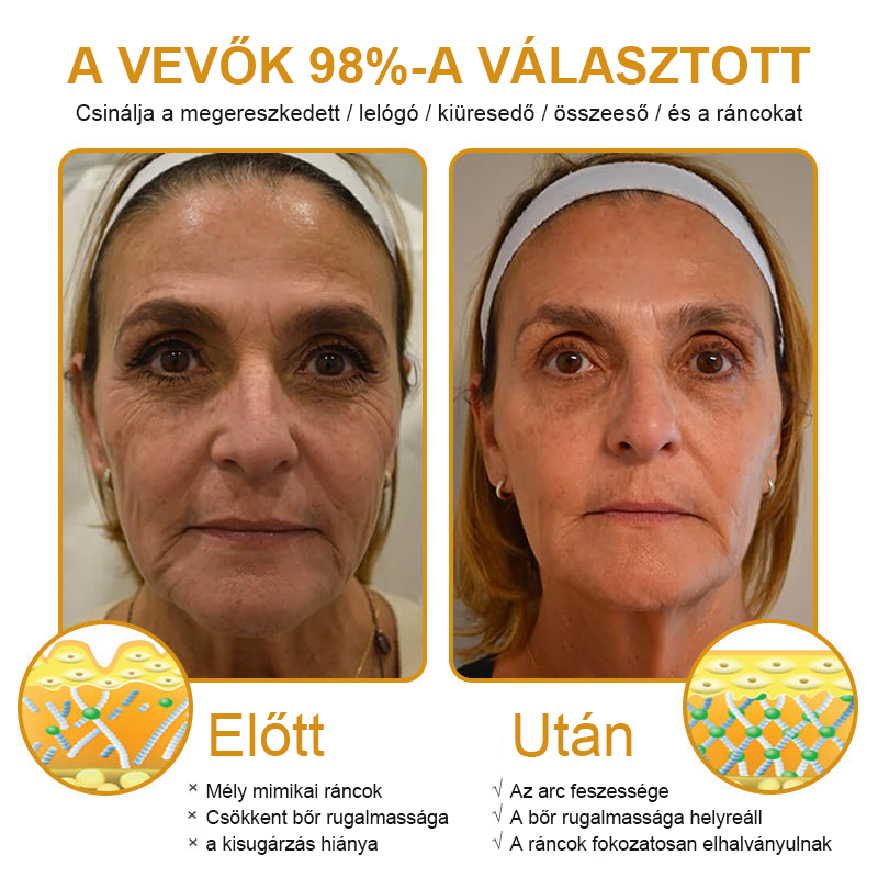 🥰FrissArc™ Botox Méhméreg Ránctalanító Krém